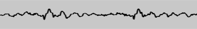 eine schwarze Oszilloskoplinie, die die Wellenform eines Audiosignals zeigt